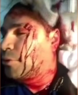 В Харькове жестоко избили депутата (ТВ, видео)