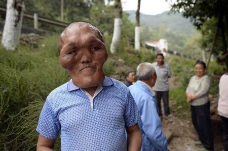 Китаец с лицом инопланетянина мечтает вернуть себе "человеческую внешность". ФОТО