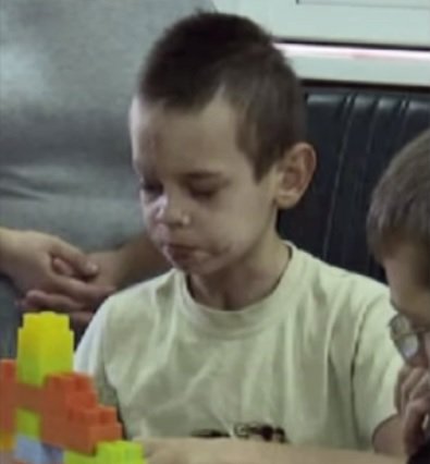 Запорожские врачи вернули 11-летнего Николая "с того света" (ТВ, видео)