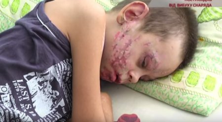 В Запорожье на снаряде подорвались маленькие дети (ТВ, видео)