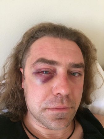 Екс-дружина Мірошниченко розповіла про подробиці бійки