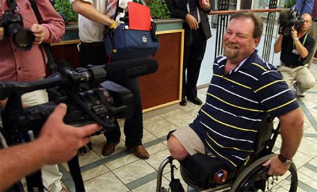 Найдивовижніші травми, після яких вижила людина. ФОТО