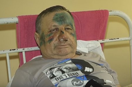 В Черкасской области жестоко избили Главу сельсовета (ТВ, видео)