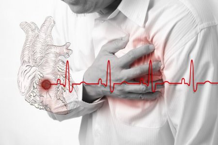 Скрытые признаки угрозы сердечного приступа - медики