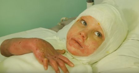 На Николаевщине ребенок попал под напряжение 27 000 Вольт (ТВ, видео)