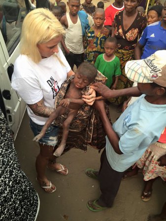 Волонтеры подарили вторую жизнь брошенному ребенку из Нигерии. Трогательные фото