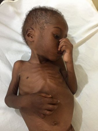 Волонтеры подарили вторую жизнь брошенному ребенку из Нигерии. Трогательные фото