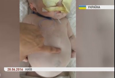 Волонтеры: В столичной больнице годовалая сирота брошена на произвол судьбы. ВИДЕО