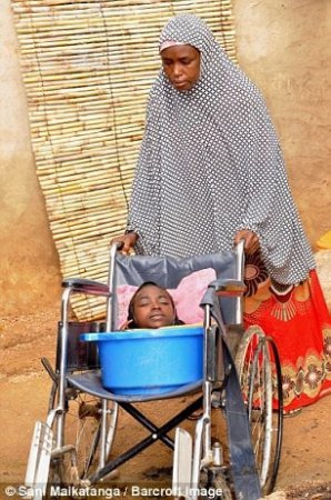 Жуткие кадры: Девушка из Нигерии с телом младенца живет в тазу. ФОТО