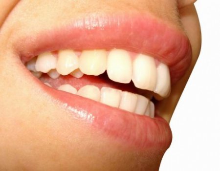 Запах изо рта может свидетельствовать о заболеваниях