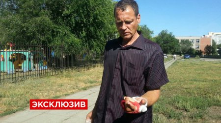 Россиянин, желающий наказать полицию за изнасилование жены, отрезал себе второй палец