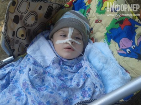 В Севастополе трехлетний ребенок стал инвалидом после удаления апендицита