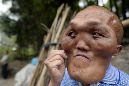 Китаец с лицом инопланетянина мечтает вернуть себе "человеческую внешность". ФОТО