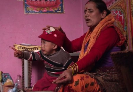На спине маленького ребенка, который живет в Непале, растет третья ручка. ФОТО