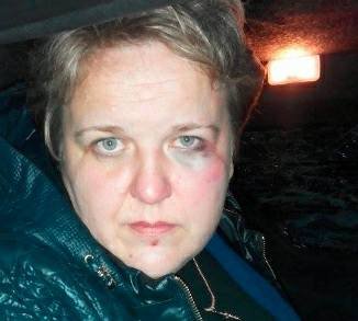 В Коцюбинском избита активистка, мать двоих детей и жена участника АТО