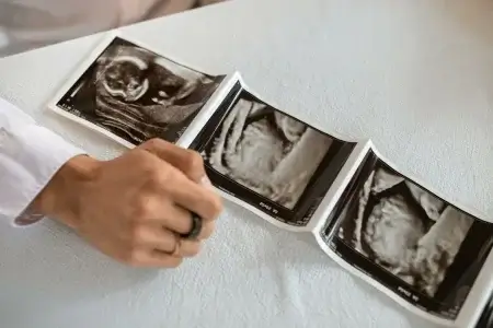 Партнерські пологи: що собою являють?